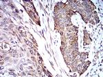 TRIM25 Antibody in Immunohistochemistry (Paraffin) (IHC (P))