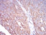 TUBB1 Antibody in Immunohistochemistry (Paraffin) (IHC (P))