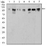 ULK2 Antibody in Western Blot (WB)