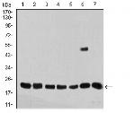 SELS Antibody in Western Blot (WB)