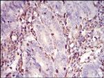 WASP Antibody in Immunohistochemistry (Paraffin) (IHC (P))