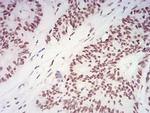 XRN2 Antibody in Immunohistochemistry (Paraffin) (IHC (P))