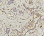 GLUT1 Antibody in Immunohistochemistry (Paraffin) (IHC (P))