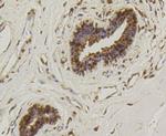 HSP70 Antibody in Immunohistochemistry (Paraffin) (IHC (P))