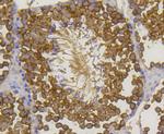 HSP70 Antibody in Immunohistochemistry (Paraffin) (IHC (P))