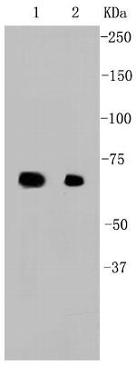 HSP70 Antibody in Western Blot (WB)