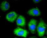 VCAM-1 (CD106) Antibody in Immunocytochemistry (ICC/IF)