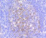 VCAM-1 (CD106) Antibody in Immunohistochemistry (Paraffin) (IHC (P))