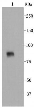VCAM-1 (CD106) Antibody in Western Blot (WB)