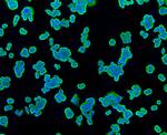 TSPO Antibody in Immunocytochemistry (ICC/IF)