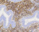 CD271 (NGF Receptor) Antibody in Immunohistochemistry (Paraffin) (IHC (P))