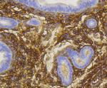 CD271 (NGF Receptor) Antibody in Immunohistochemistry (Paraffin) (IHC (P))