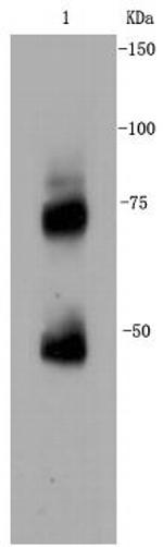 CD271 (NGF Receptor) Antibody in Western Blot (WB)