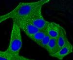 ALAS1 Antibody in Immunocytochemistry (ICC/IF)