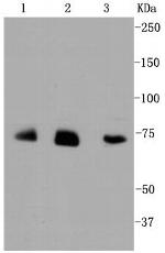 ALAS1 Antibody in Western Blot (WB)