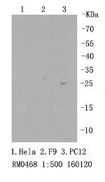 RPS3 Antibody in Western Blot (WB)