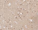 JNK1/JNK2/JNK3 Antibody in Immunohistochemistry (Paraffin) (IHC (P))