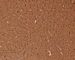 JNK1/JNK2/JNK3 Antibody in Immunohistochemistry (Paraffin) (IHC (P))