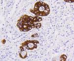 Cytokeratin 19 Antibody in Immunohistochemistry (Paraffin) (IHC (P))