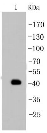 Cytokeratin 19 Antibody in Western Blot (WB)