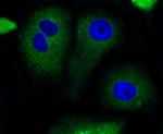 BAD Antibody in Immunocytochemistry (ICC/IF)