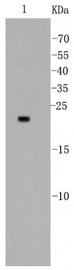 BAD Antibody in Western Blot (WB)