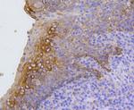 Cytokeratin 17 Antibody in Immunohistochemistry (Paraffin) (IHC (P))