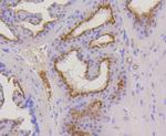 Cytokeratin 17 Antibody in Immunohistochemistry (Paraffin) (IHC (P))