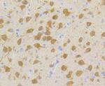 CDK5 Antibody in Immunohistochemistry (Paraffin) (IHC (P))