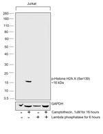 Phospho-Histone H2A.X (Ser139) Antibody