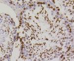 Phospho-Histone H2A.X (Ser139) Antibody in Immunohistochemistry (Paraffin) (IHC (P))