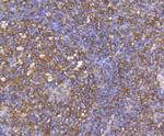 CCR7 Antibody in Immunohistochemistry (Paraffin) (IHC (P))