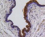 PUMA alpha Antibody in Immunohistochemistry (Paraffin) (IHC (P))