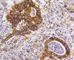 PUMA alpha Antibody in Immunohistochemistry (Paraffin) (IHC (P))