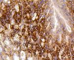 PUMA alpha Antibody in Immunohistochemistry (Paraffin) (IHC (P))