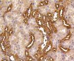 MEK1/MEK2 Antibody in Immunohistochemistry (Paraffin) (IHC (P))