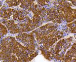 Prohibitin Antibody in Immunohistochemistry (Paraffin) (IHC (P))