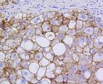 SR-BI Antibody in Immunohistochemistry (Paraffin) (IHC (P))