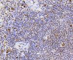 SR-BI Antibody in Immunohistochemistry (Paraffin) (IHC (P))