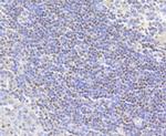 H2AK9ac Antibody in Immunohistochemistry (Paraffin) (IHC (P))