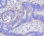 H2AK9ac Antibody in Immunohistochemistry (Paraffin) (IHC (P))