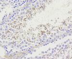 H2AK9ac Antibody in Immunohistochemistry (Paraffin) (IHC (P))