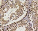 Hydroxyl-Histone H2A (Tyr39) Antibody in Immunohistochemistry (Paraffin) (IHC (P))