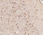 IFNAR1 Antibody in Immunohistochemistry (Paraffin) (IHC (P))