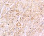 IFNAR1 Antibody in Immunohistochemistry (Paraffin) (IHC (P))