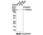 IFNAR1 Antibody in Western Blot (WB)