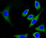 beta-5 Tubulin Antibody in Immunocytochemistry (ICC/IF)