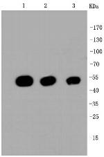 beta-5 Tubulin Antibody in Western Blot (WB)