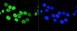 H4K5ac Antibody in Immunocytochemistry (ICC/IF)