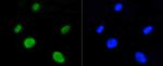 H4K5ac Antibody in Immunocytochemistry (ICC/IF)